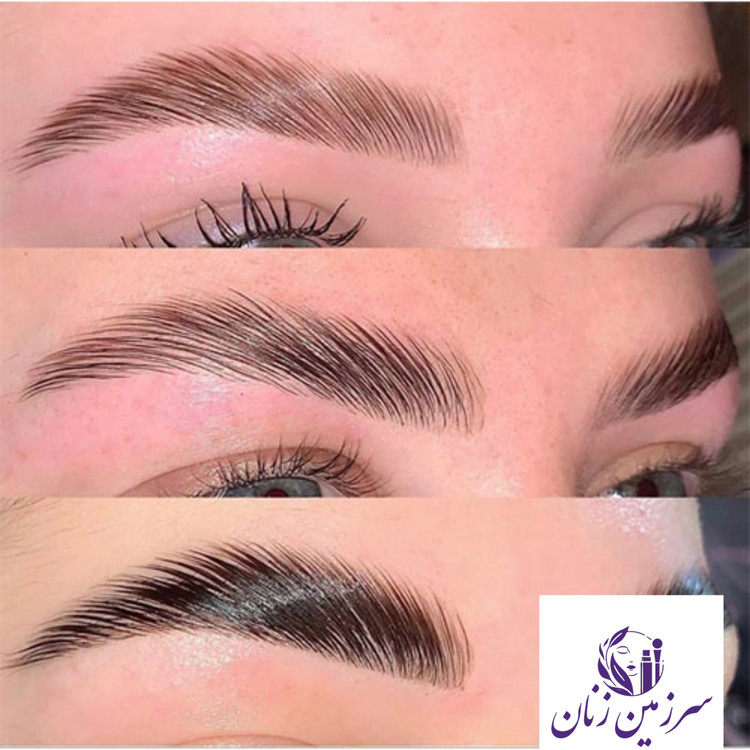 ژل لیفت ابرو مشکی کلینیک اورجینال