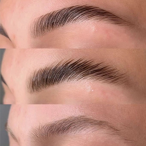 ژل لیفت ابرو مشکی کلینیک اورجینال